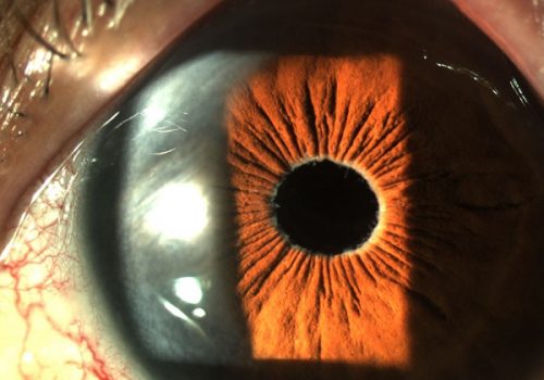 Ojo izquierdo