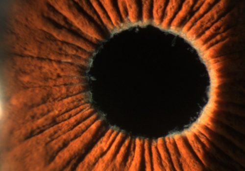 Ojo izquierdo