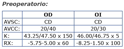untitled Caso Refractiva Astigmatismo Irregular, Queratocono