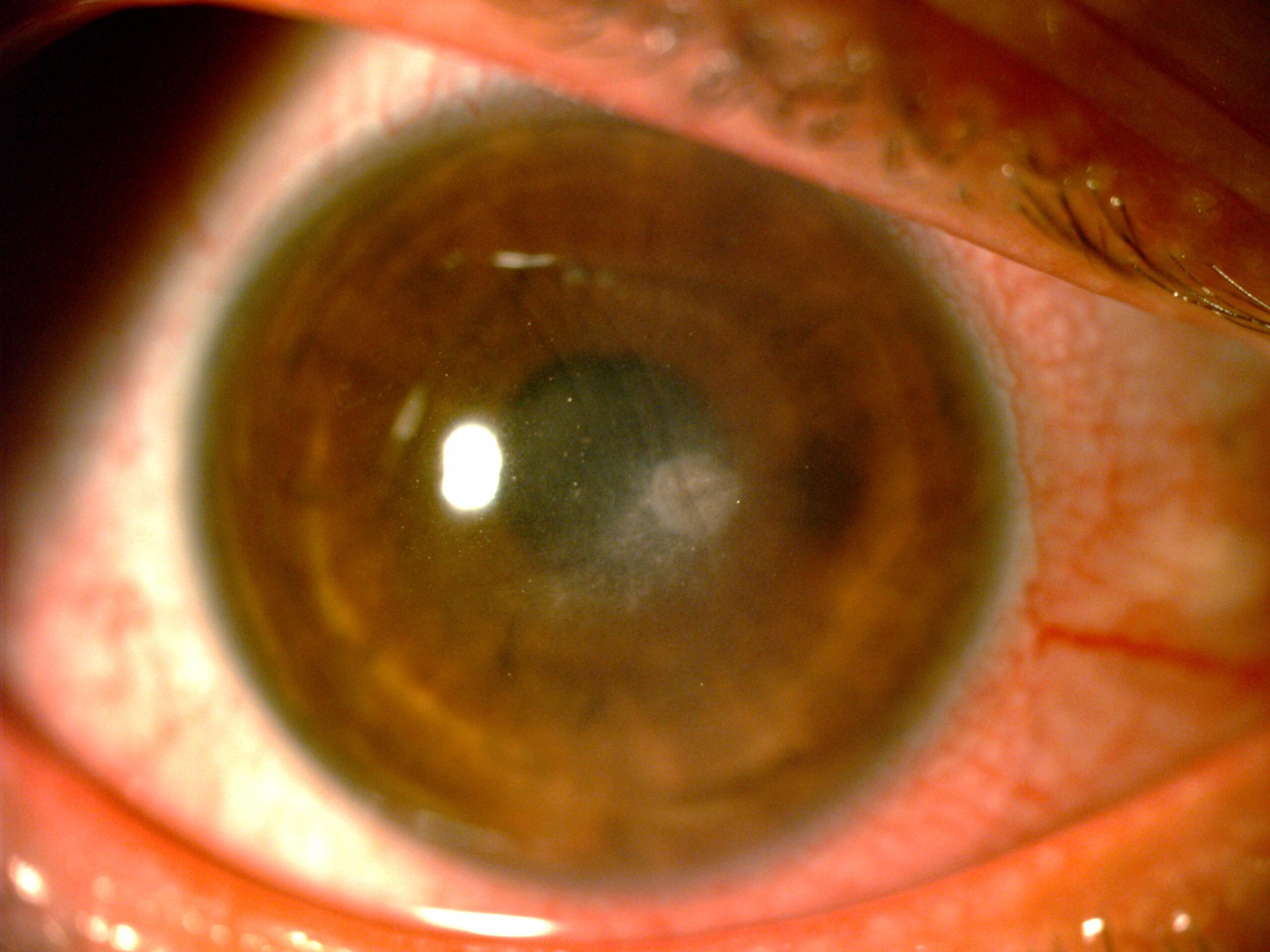 Fig 1B Fig 1B